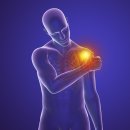 화인정형외과의원 이미지