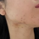 씨유어양퍼스트점 | 다이소 파티온 노스카나인 퍼스트스텝 흔적 수분크림 내돈내산 2주사용후기