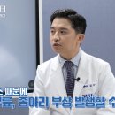 다리 종아리 근육 파열, 테니스레그 이미지