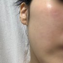 (주)모드 | 홈모드 써마 리프트 | 내돈내산 8주차 후기