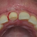 거성치과기공소 이미지