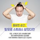 대구비절개모발이식 안심하고 받으려면 이미지