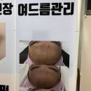 솜뷰티 - 강릉시 | 솜뷰티