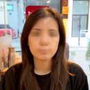 빈웨이브 | 압구정로데오 피부과 힐로웨이브 효과 내돈내산 후기