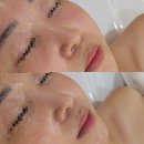 남천 | 남천동 피부관리 레몬트리에스테틱 남천점 솔직후기
