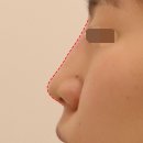 하이코코 이미지