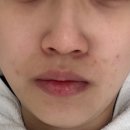 리포즈에스테틱 파주운정점