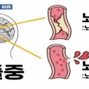 골든타임B 이미지