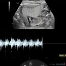 헤스티아여성의원 | [14주차] 분당헤스티아여성의원 진료 - 균검사, 아가진료