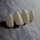 남수원웰치과의원 | 치아 걱정은 이제 그만! 찐텐으로 깔아보는 H플란트치과 체험기