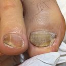 도담동_라온프라이빗 우측 | 발톱 관리, 아빠 모시고 레푸스 수원광교점 다녀온 후기 👣 레푸스 비용 레푸스 가격 (안소정푸스플레게)