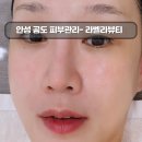 안성 공도 피부 리프팅 케어 후기 | 주말 예약 가능한 라벨라 뷰티