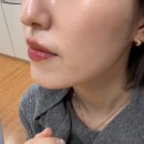 제림은탑맨션경로당 | 올리제뷰티 | 수성구 피부관리 잘하는 에스테틱 추천, 대구 모공관리, 시지 피부관리