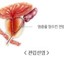 남자 여자 혈뇨 원인 이상 증상으로 연관질환 알아보기 이미지