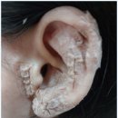 바이오힐링센타 네이버블로그