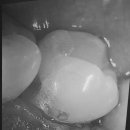 연세보스톤치과의원 이미지