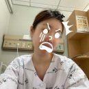 꼬메스타 | 수족다한증 수술 후기｜3년차 리얼 썰: 보상성다한증? 흉터? 보험은?