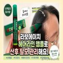 출산 100일 후 시작된 산후탈모 라보에이치 헤어라인 앰플 사용으로 탈모완화 해줘요