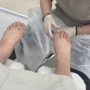 제이메디컬 | 수원무좀치료 고민이라면? 발톱스케일링으로 해결한 수원발톱관리 후기