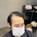 자연스러움에 두 번 놀라게 되는 시스루 댄디 가발 컨설팅 -대구 서구 내당동 미용실 미스리 내당점