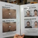 누가한의원 | 얼굴비대칭(안면비대칭) 교정 한의원 15회 전후비교 후기