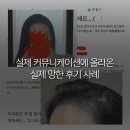 박원장헤어 | 20대 여자 헤어라인두피문신 1회만에 시술 완성? 제발 속지마세요 (망하기전에 필독하세요)