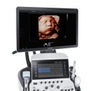 삼성의료기 이미지