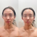 김용주 | 왕십리 윤곽관리 추천｜정율환골윤곽연구소 환골윤곽 테라피 후기