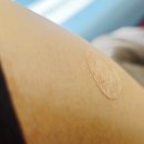 미즈여성아동병원 | 없음 이슈로 예방접종(MMR 주사(풍진 포함 복합백신), A형 간염(성인))-미즈여성아동병원에서 접종한 후기