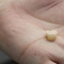 플러스치과기공소 이미지