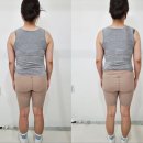 광주 윤곽관리 리유에스테틱 얼굴 비대칭 바디라인 고민 1회로 느낀 변화