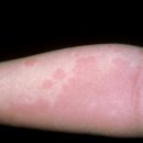 미소로한의원 이미지