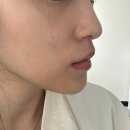 앤와이유정치과의원 | 주걱턱 교정 치과에서 알려주는 제대로 '턱교정' 받는 방법