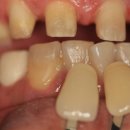 민치과기공소 이미지