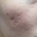 사월의봄한의원 이미지