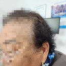덕진-84 | 84세 어머니 시그니아 퓨어 C&amp;G 5AX 보청기 착용 후기 — 전주 세계로보청기 전주점 방문기