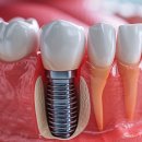 열린오치과의원 이미지