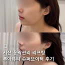 한마음슈퍼 | 서산 윤곽관리 리프팅 잘하는 루아뷰티 슈퍼브이턱 후기