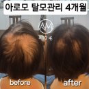 아로모탈모두피클리닉