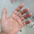 루루 인셀덤 | 김태희샴푸 x 보타랩 임산부탈모완화에 효과본 1인 열무맘 찐 후기!