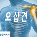 인천 논현 정형외과 오십견 증상과 치료방법 이미지