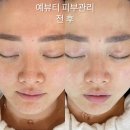 예뷰티스킨케어 이미지