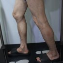 광명연세흉부외과의원 | 종아리시림, 나이 탓으로 넘기다가 더 큰 문제가 됩니다. <더행복한흉부외과>