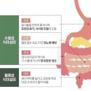 위고크린