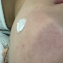 구월한의원 | [인천/구월]포메디 한의원 점제거 후기