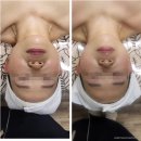 힐링스파 이미지