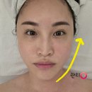 아름다운피부 | 울산 남구 리프팅 피부관리 아름다운차이 V-LIFT 360 후기