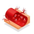 혈관 누수로 출혈성 쇼크 유발/원인과 증상/치료 예방