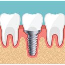 매디플란트 치과의원 이미지