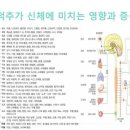 바른자세척추운동(SNPE) 이미지